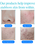 Clear Confidence Trio Kit