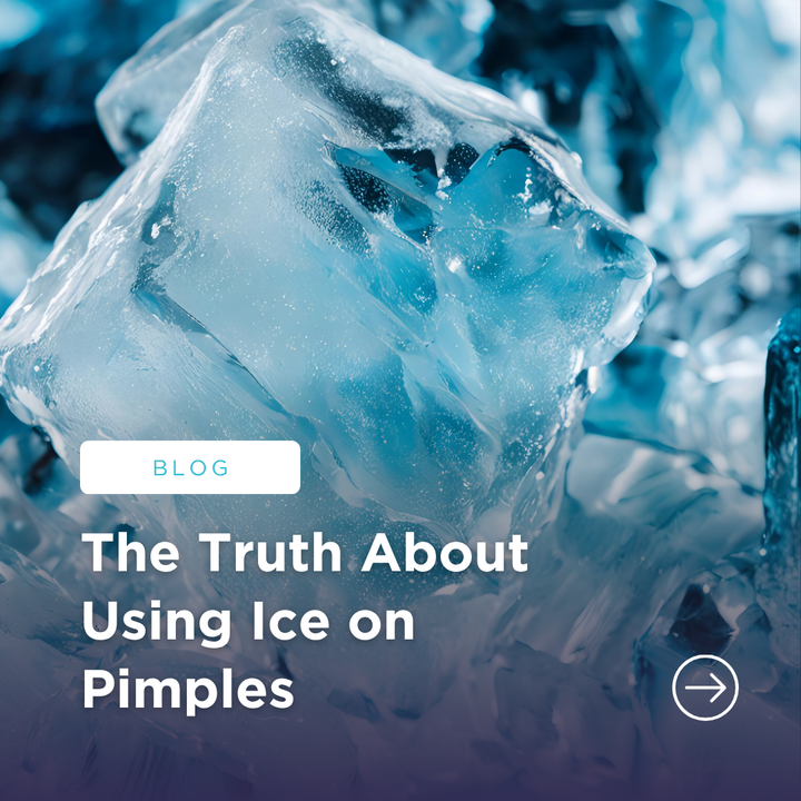 The Truth About Using Ice on Pimples