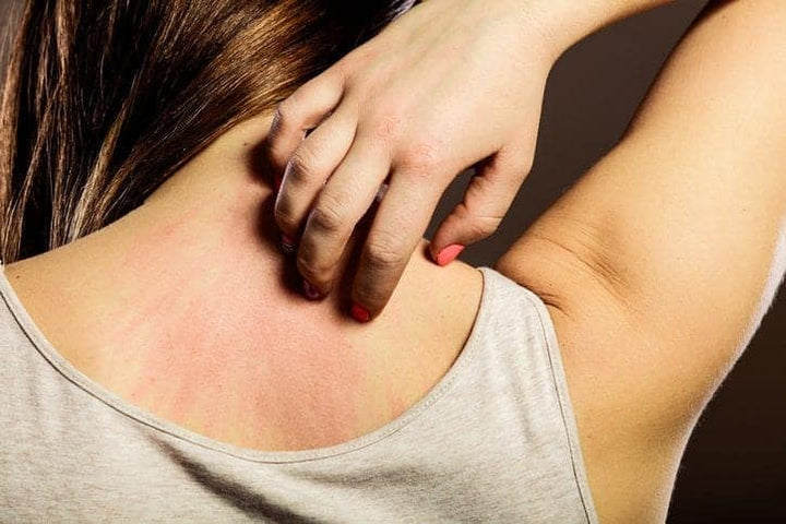 What to do for Back Acne