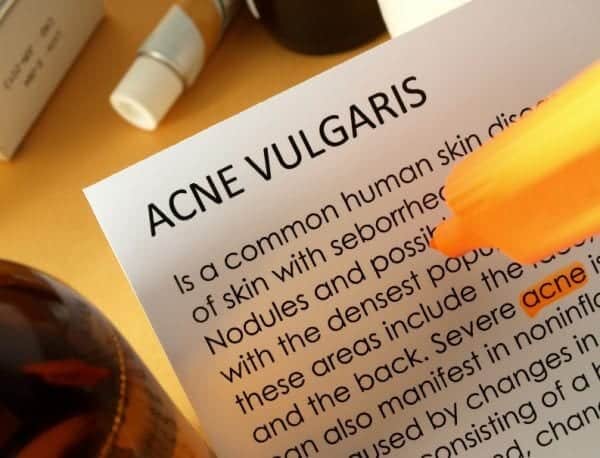 Different Types of Pimples and How to Treat Them?