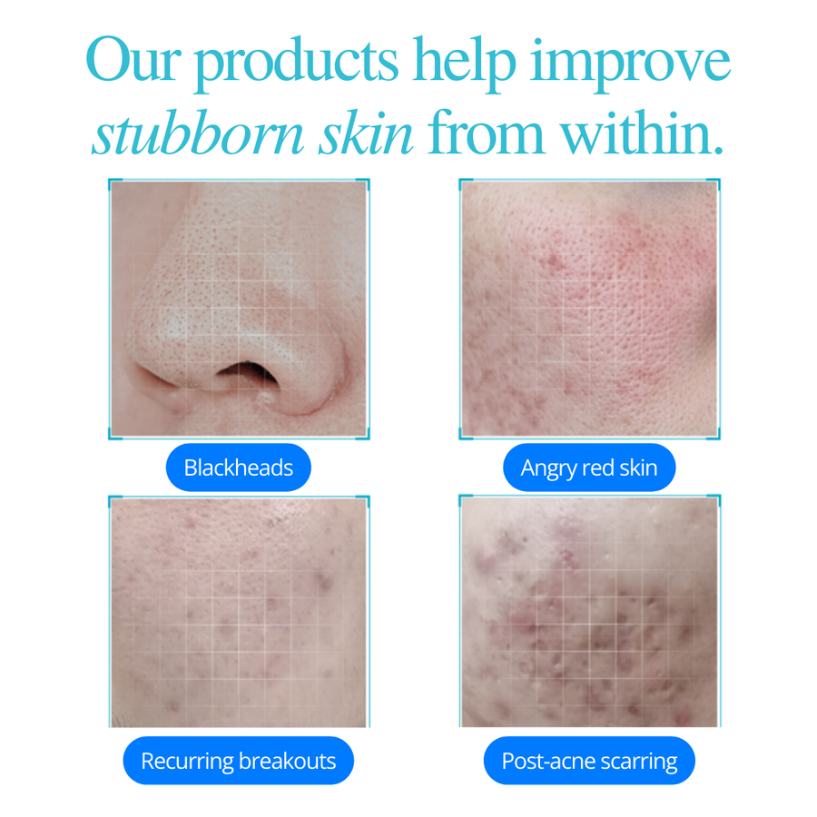 Clear Confidence Trio Kit